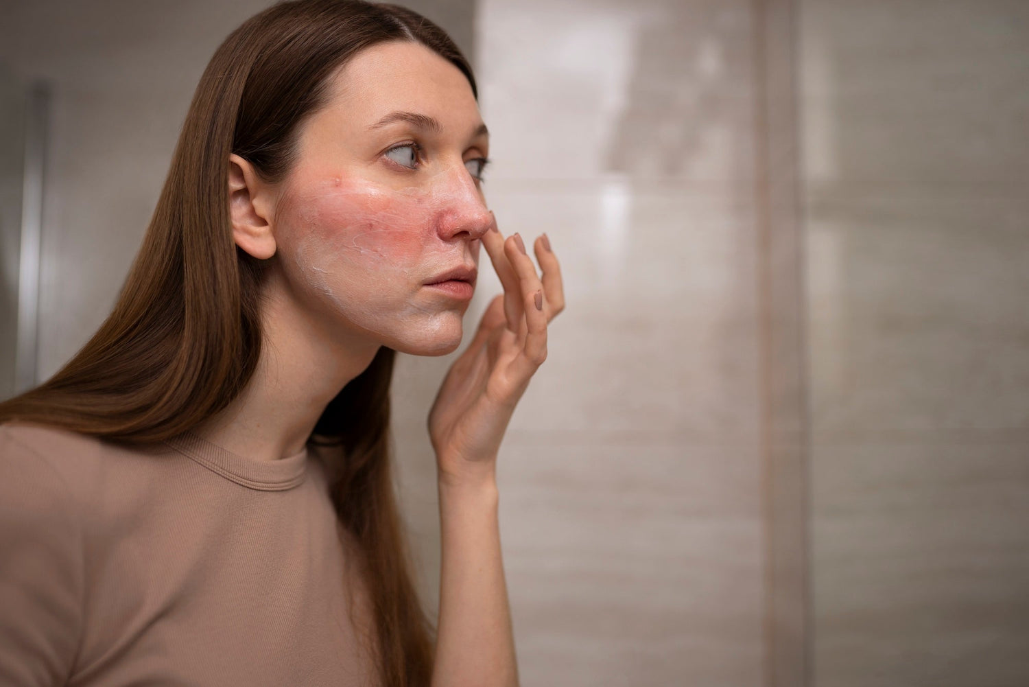 Woman looking at Rosacea in mirror