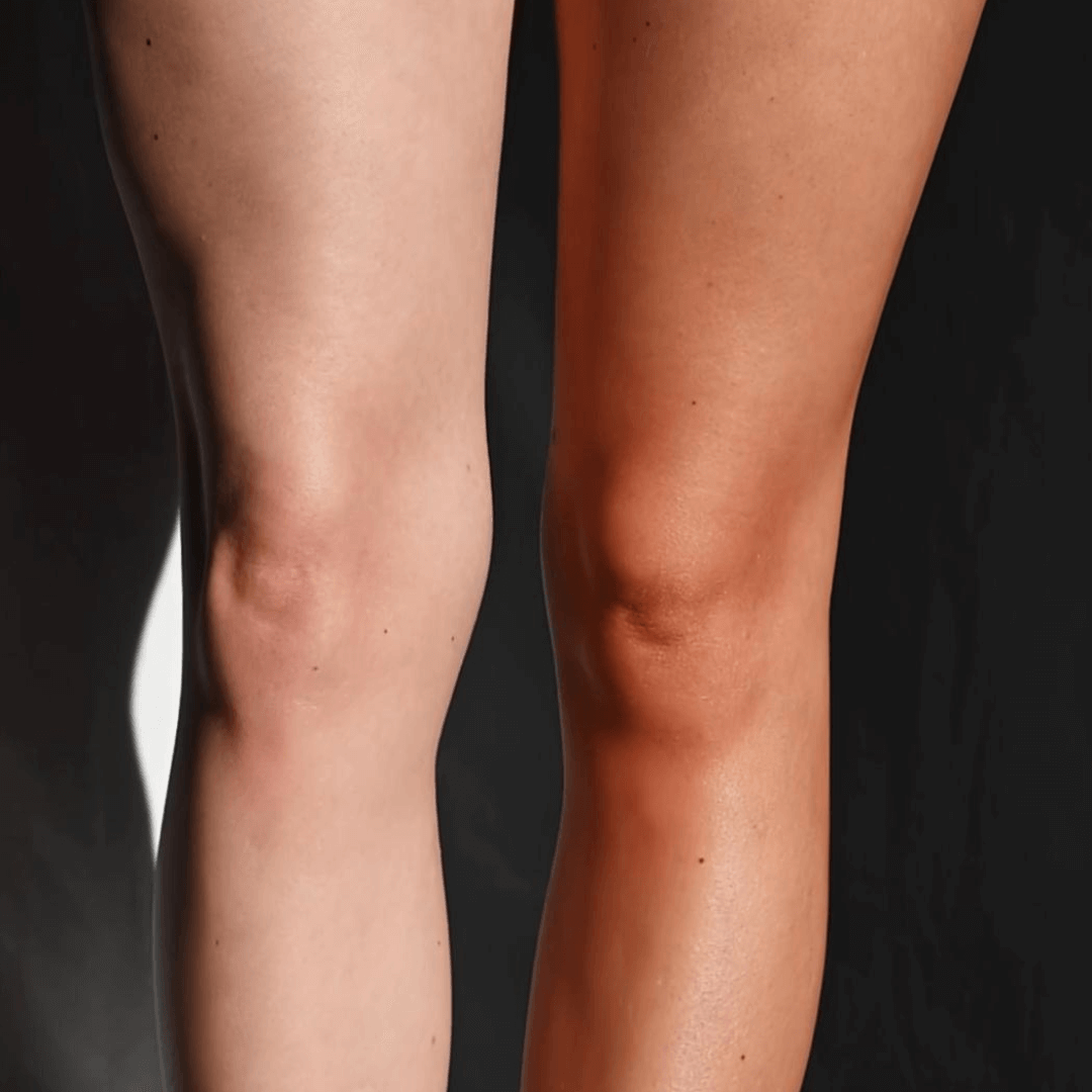 Evy Technology Self Tan Mousse Light Medium Model Legs